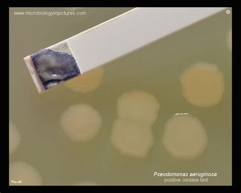 oxidase test for pseudomonas aeruginosa